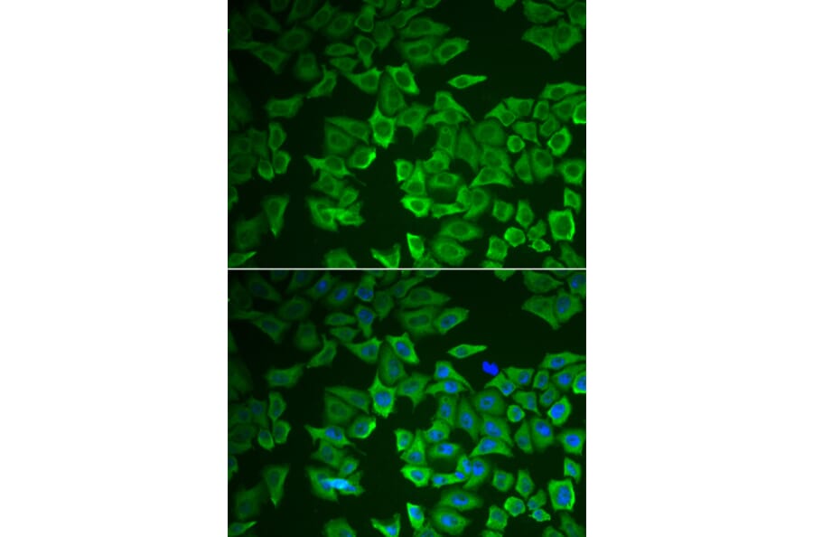 Immunofluorescence - CRHBP antibody from Signalway Antibody (39014) - Antibodies.com