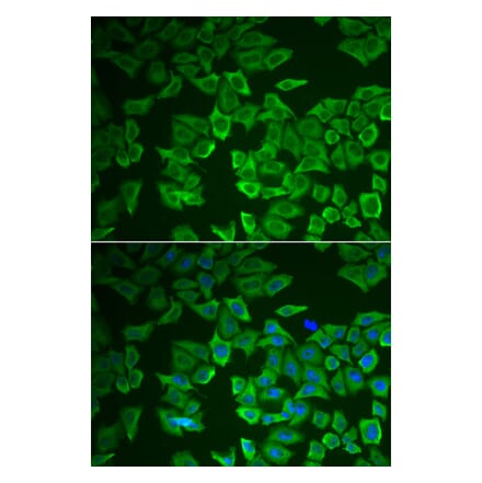 Immunofluorescence - CRHBP antibody from Signalway Antibody (39014) - Antibodies.com