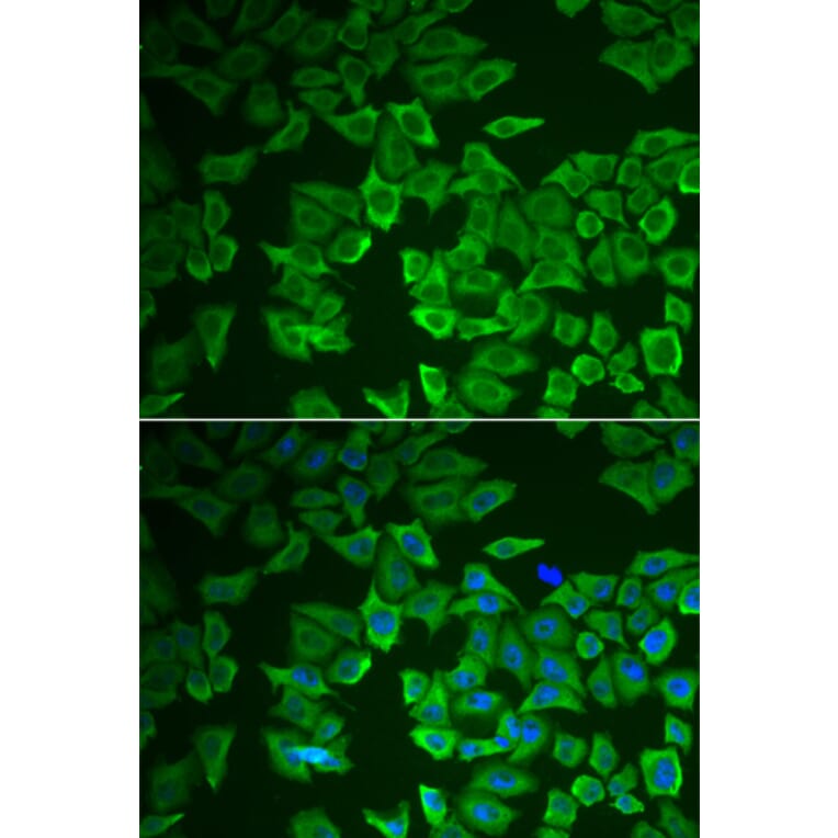 Immunofluorescence - CRHBP antibody from Signalway Antibody (39014) - Antibodies.com