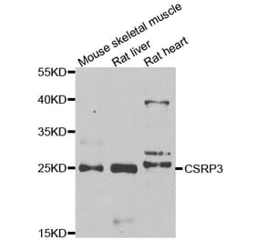 Western blot - CSRP3 antibody from Signalway Antibody (39015) - Antibodies.com