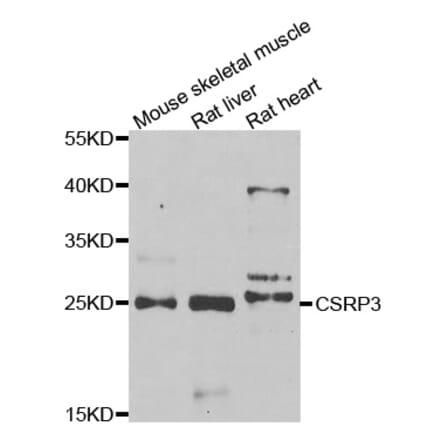 Western blot - CSRP3 antibody from Signalway Antibody (39015) - Antibodies.com