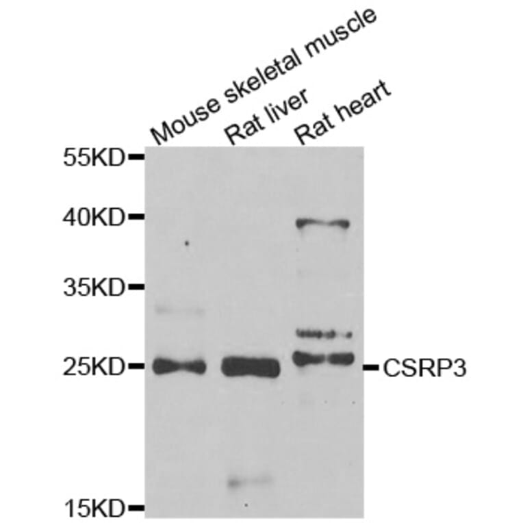 Western blot - CSRP3 antibody from Signalway Antibody (39015) - Antibodies.com