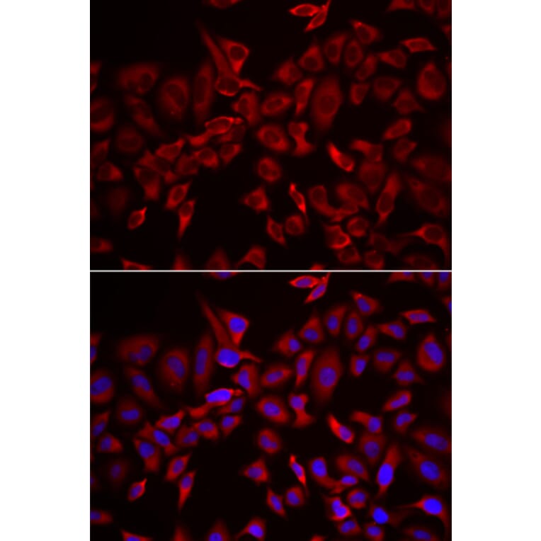 Immunofluorescence - CSRP3 antibody from Signalway Antibody (39015) - Antibodies.com