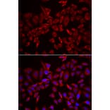 Immunofluorescence - CSRP3 antibody from Signalway Antibody (39015) - Antibodies.com