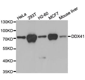 Western blot - DDX41 antibody from Signalway Antibody (39020) - Antibodies.com