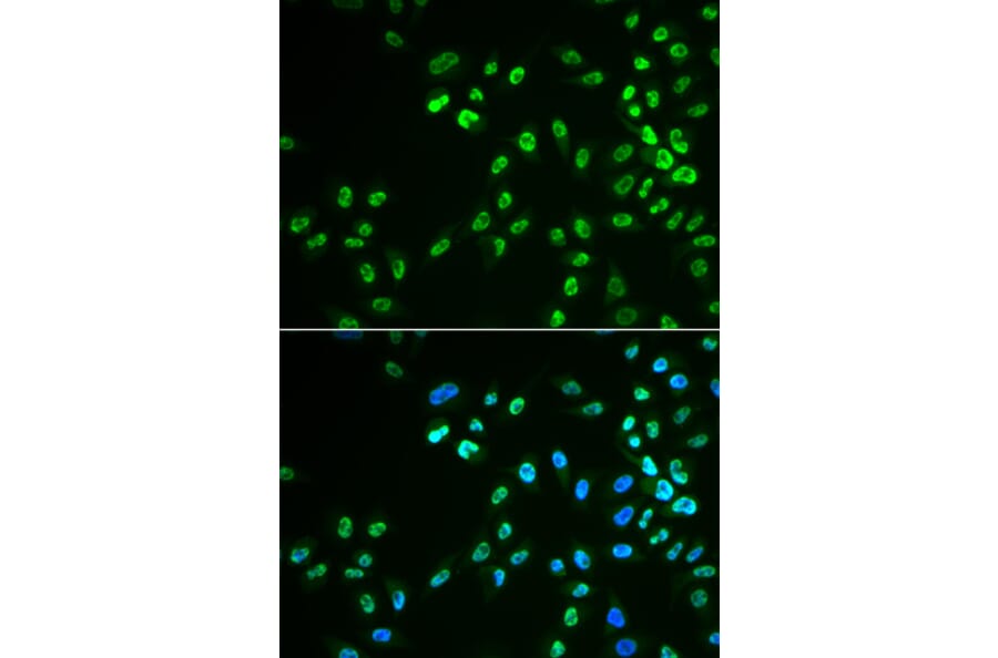 Immunofluorescence - DDX41 antibody from Signalway Antibody (39020) - Antibodies.com