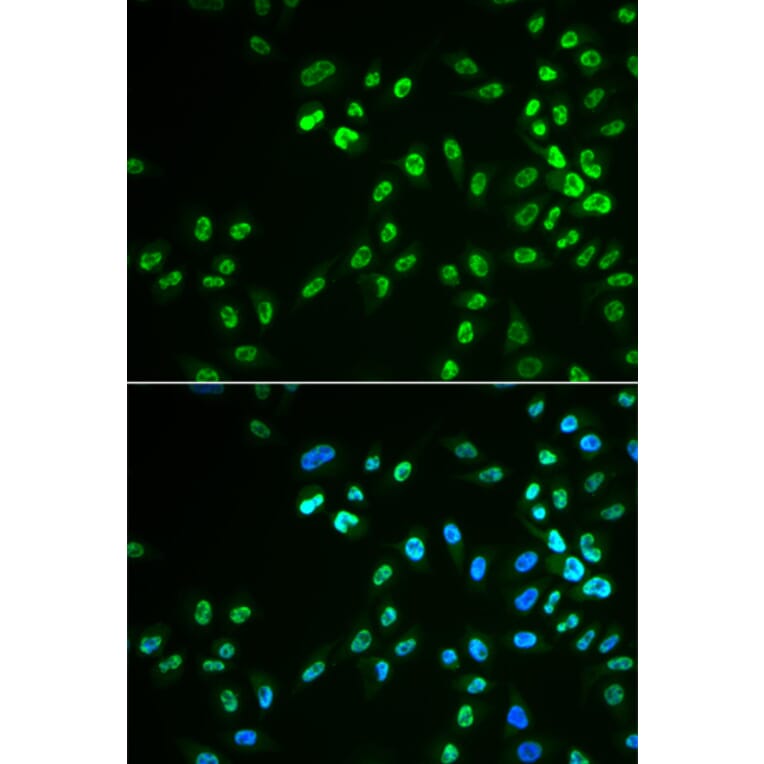 Immunofluorescence - DDX41 antibody from Signalway Antibody (39020) - Antibodies.com