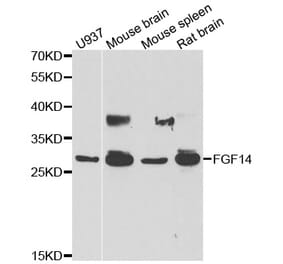 Western blot - FGF14 antibody from Signalway Antibody (39028) - Antibodies.com