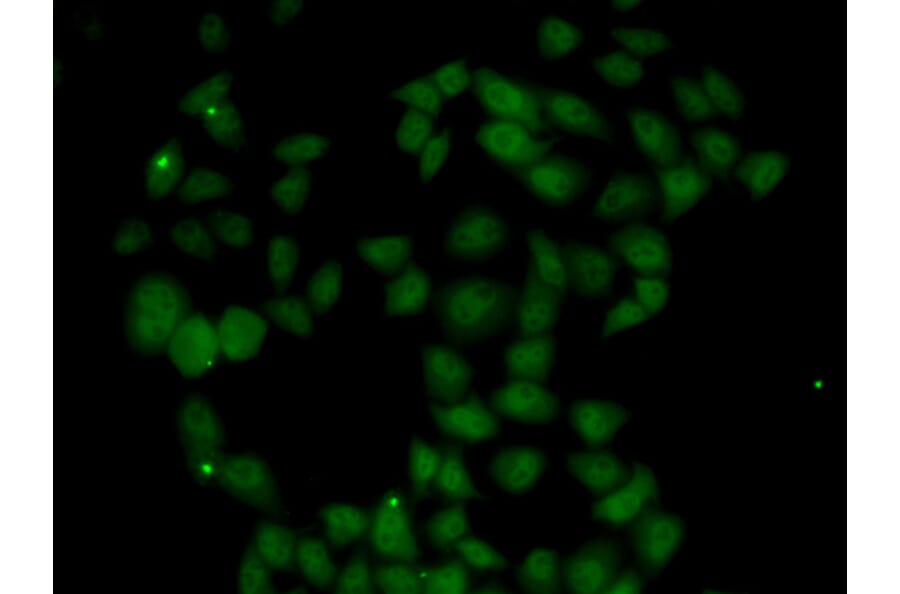 Immunofluorescence - FGF14 antibody from Signalway Antibody (39028) - Antibodies.com