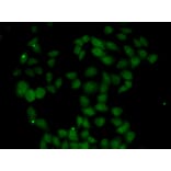 Immunofluorescence - FGF14 antibody from Signalway Antibody (39028) - Antibodies.com