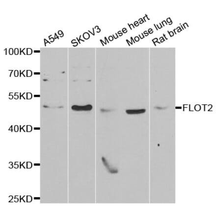 Western blot - FLOT2 antibody from Signalway Antibody (39029) - Antibodies.com