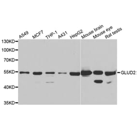 Western blot - GLUD2 antibody from Signalway Antibody (39038) - Antibodies.com
