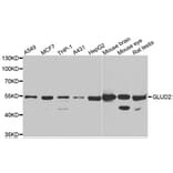 Western blot - GLUD2 antibody from Signalway Antibody (39038) - Antibodies.com