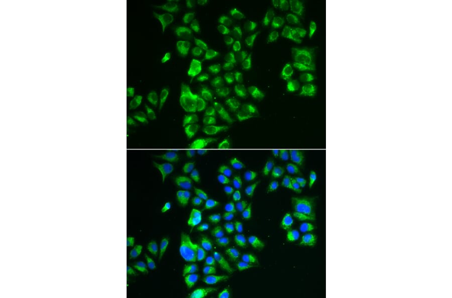 Immunofluorescence - GLUD2 antibody from Signalway Antibody (39038) - Antibodies.com