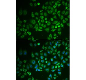 Immunofluorescence - GPLD1 antibody from Signalway Antibody (39044) - Antibodies.com