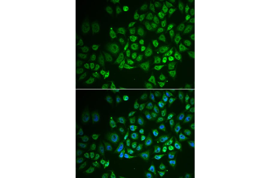 Immunofluorescence - GPLD1 antibody from Signalway Antibody (39044) - Antibodies.com