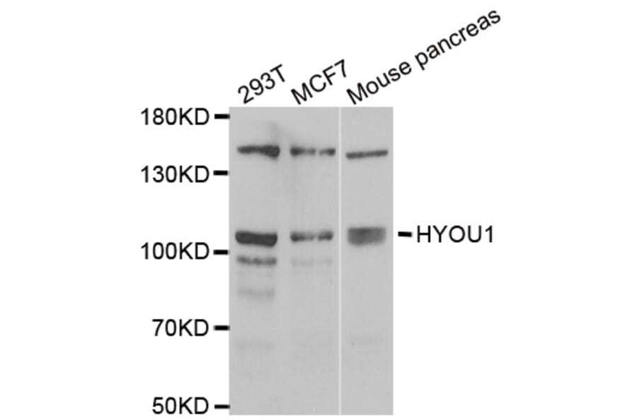 Western blot - HYOU1 antibody from Signalway Antibody (39053) - Antibodies.com