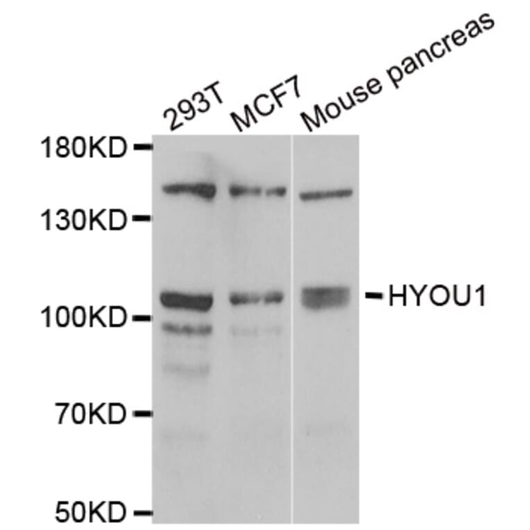 Western blot - HYOU1 antibody from Signalway Antibody (39053) - Antibodies.com