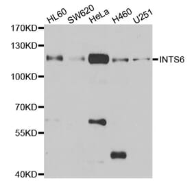 Western blot - INTS6 antibody from Signalway Antibody (39060) - Antibodies.com