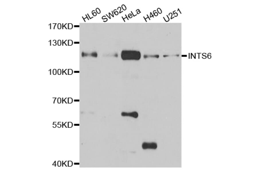 Western blot - INTS6 antibody from Signalway Antibody (39060) - Antibodies.com