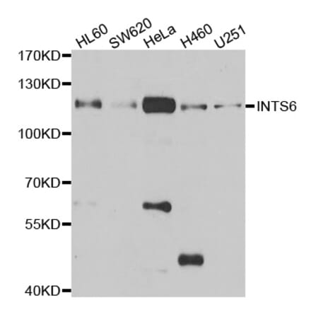 Western blot - INTS6 antibody from Signalway Antibody (39060) - Antibodies.com