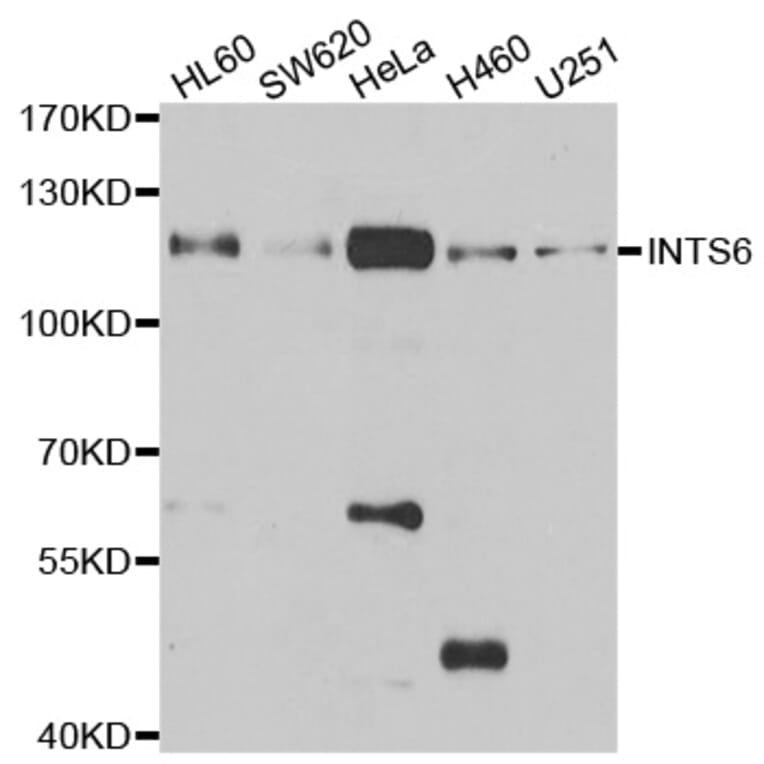 Western blot - INTS6 antibody from Signalway Antibody (39060) - Antibodies.com