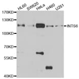 Western blot - INTS6 antibody from Signalway Antibody (39060) - Antibodies.com