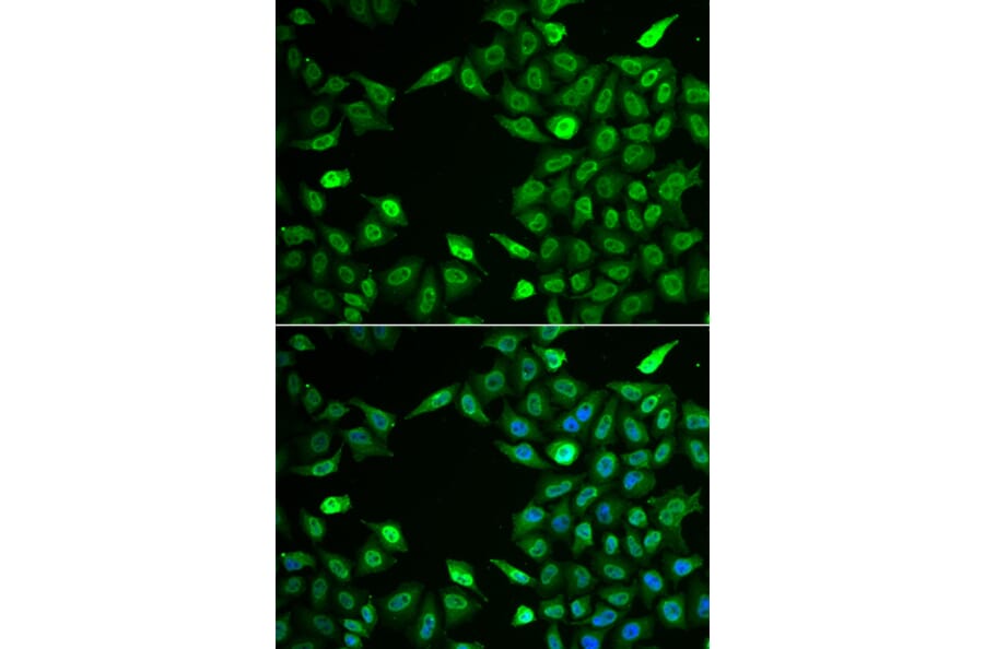 Immunofluorescence - INTS6 antibody from Signalway Antibody (39060) - Antibodies.com