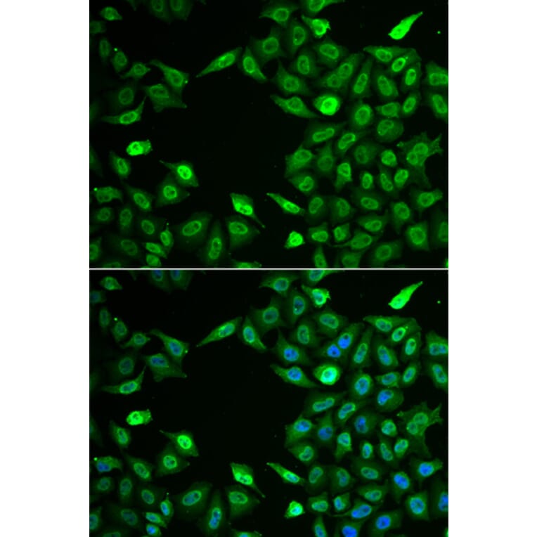 Immunofluorescence - INTS6 antibody from Signalway Antibody (39060) - Antibodies.com