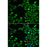 Immunofluorescence - INTS6 antibody from Signalway Antibody (39060) - Antibodies.com