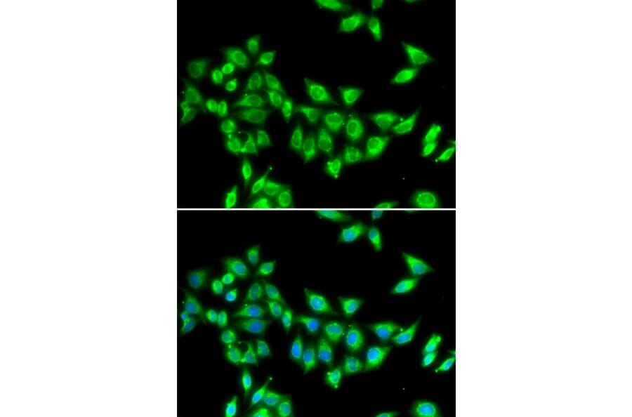 Immunofluorescence - KIF3A antibody from Signalway Antibody (39064) - Antibodies.com