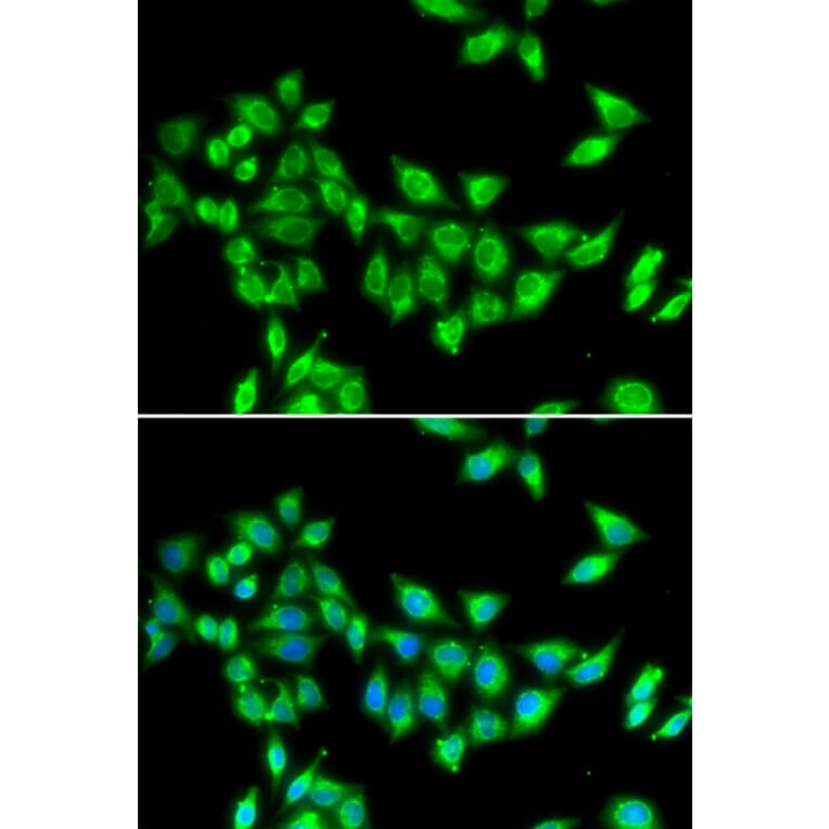 Immunofluorescence - KIF3A antibody from Signalway Antibody (39064) - Antibodies.com