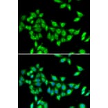 Immunofluorescence - KIF3A antibody from Signalway Antibody (39064) - Antibodies.com