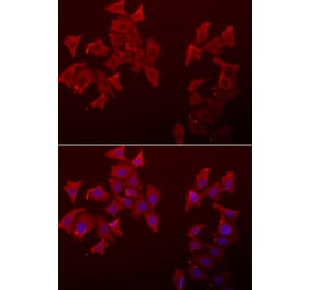 Immunofluorescence - LECT1 antibody from Signalway Antibody (39067) - Antibodies.com