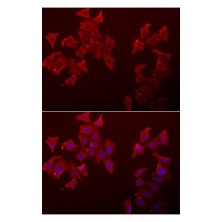 Immunofluorescence - LECT1 antibody from Signalway Antibody (39067) - Antibodies.com