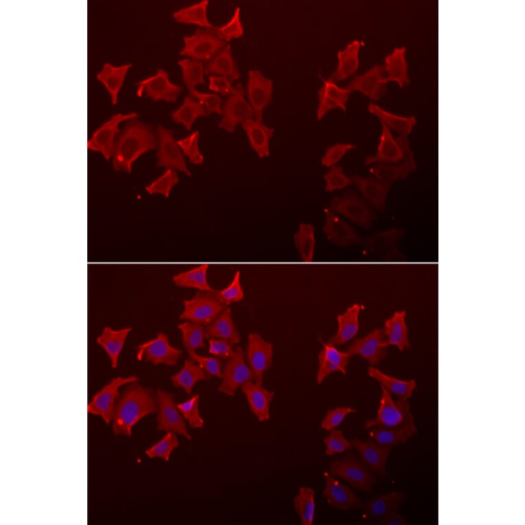 Immunofluorescence - LECT1 antibody from Signalway Antibody (39067) - Antibodies.com