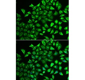 Immunofluorescence - MMRN1 antibody from Signalway Antibody (39078) - Antibodies.com