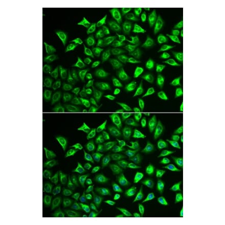 Immunofluorescence - MMRN1 antibody from Signalway Antibody (39078) - Antibodies.com