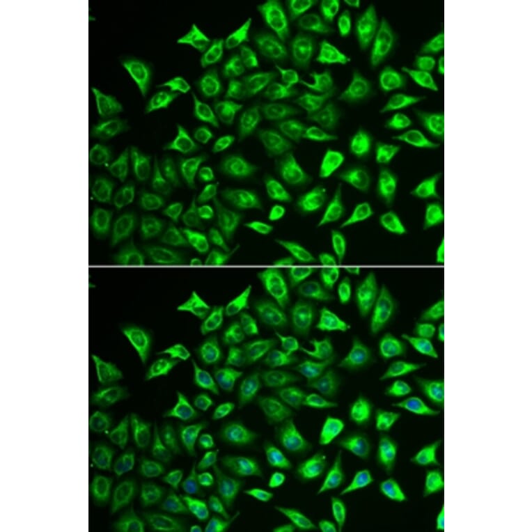 Immunofluorescence - MMRN1 antibody from Signalway Antibody (39078) - Antibodies.com