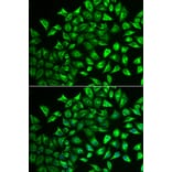 Immunofluorescence - MMRN1 antibody from Signalway Antibody (39078) - Antibodies.com