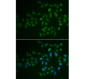 Immunofluorescence - MYLK3 antibody from Signalway Antibody (39083) - Antibodies.com
