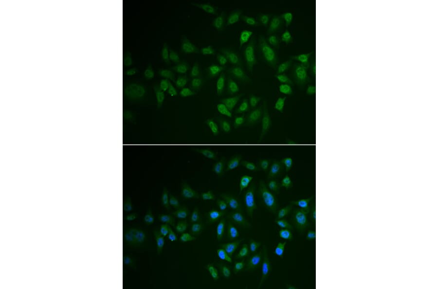 Immunofluorescence - MYLK3 antibody from Signalway Antibody (39083) - Antibodies.com