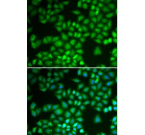 Immunofluorescence - NFKB1 antibody from Signalway Antibody (39087) - Antibodies.com