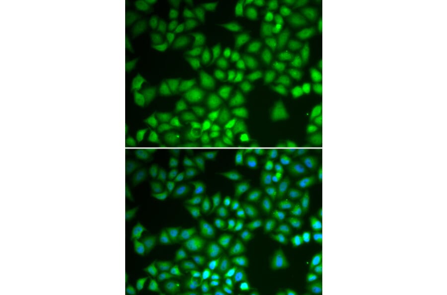 Immunofluorescence - NFKB1 antibody from Signalway Antibody (39087) - Antibodies.com