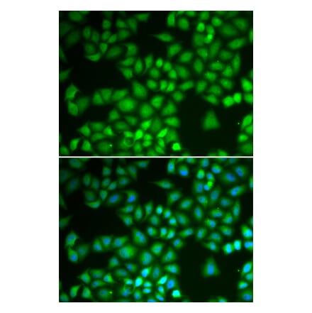 Immunofluorescence - NFKB1 antibody from Signalway Antibody (39087) - Antibodies.com