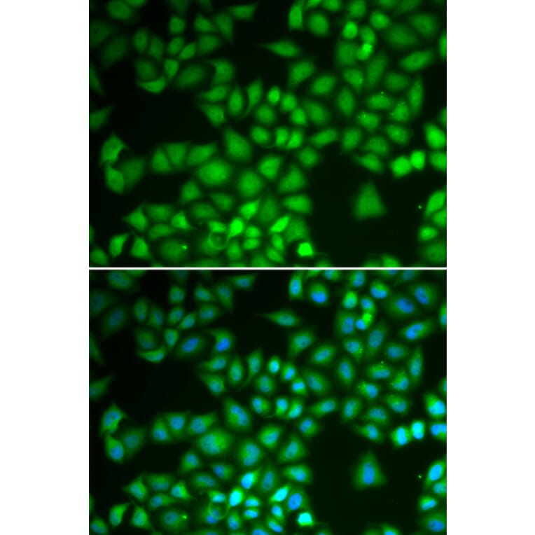 Immunofluorescence - NFKB1 antibody from Signalway Antibody (39087) - Antibodies.com