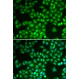 Immunofluorescence - NFKB1 antibody from Signalway Antibody (39087) - Antibodies.com