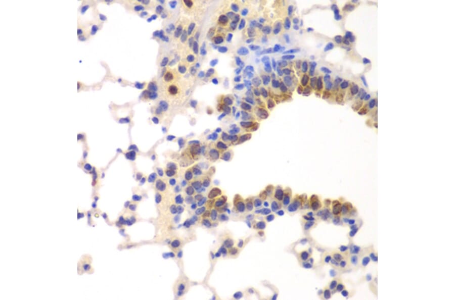 Immunohistochemistry - NFKB1 antibody from Signalway Antibody (39087) - Antibodies.com