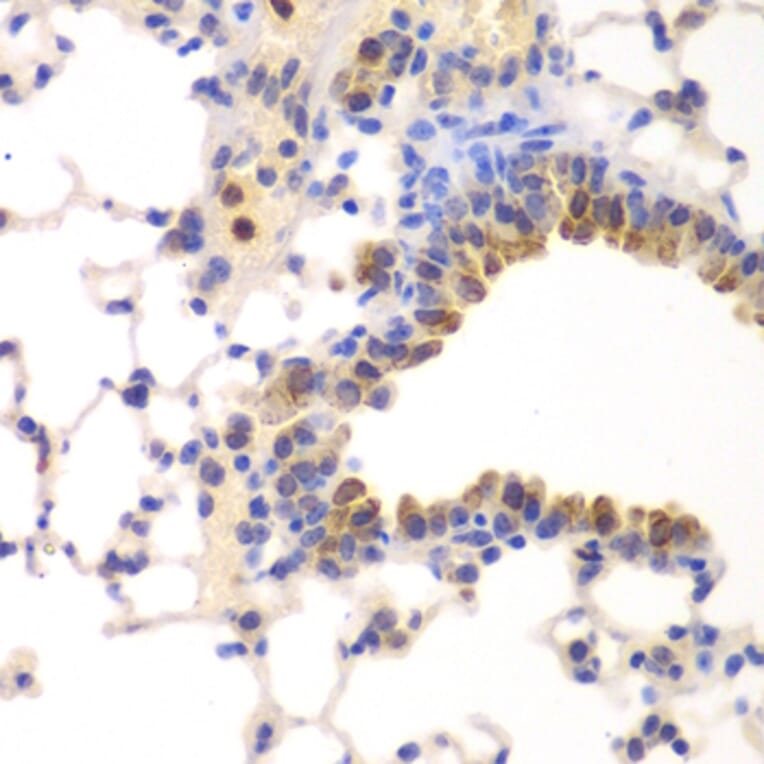 Immunohistochemistry - NFKB1 antibody from Signalway Antibody (39087) - Antibodies.com