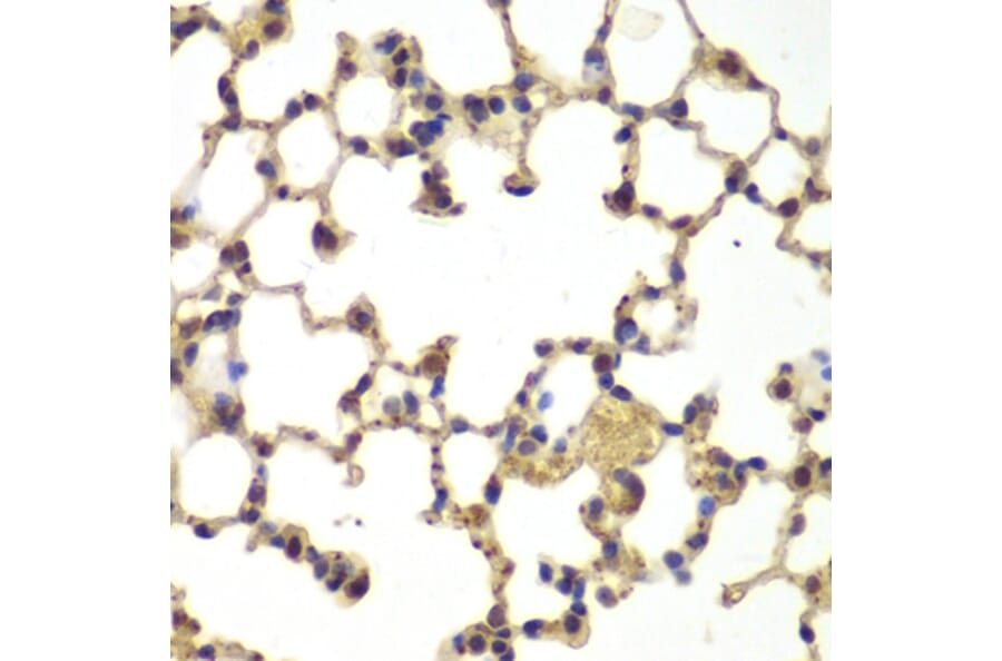 Immunohistochemistry - NFKB1 antibody from Signalway Antibody (39087) - Antibodies.com